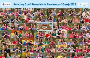 Dziś obchodzimy Światowy Dzień Stwardnienia Rozsianego